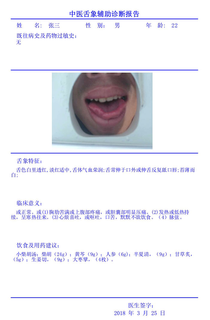中医舌诊仪诊断报告