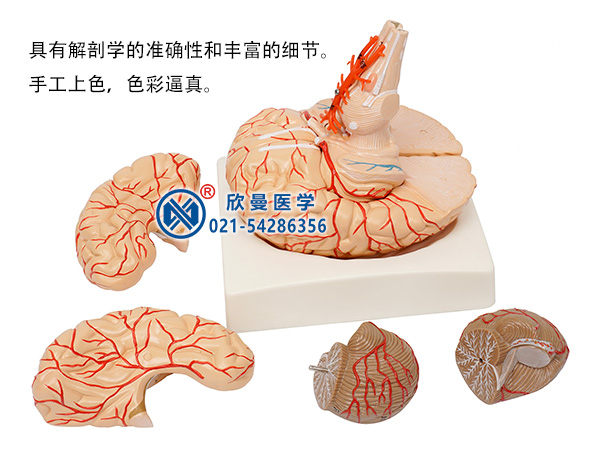 脑动脉模型分解为6部件