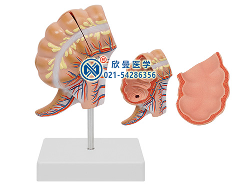 盲肠和阑尾模型