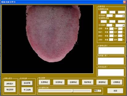 舌像仪自动获取结果