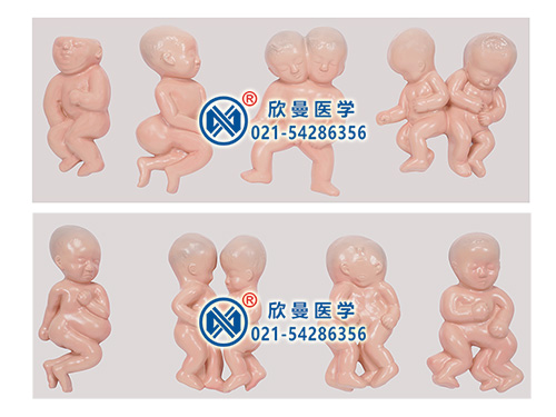 XM-805胎儿畸形模型,畸形胎儿模型