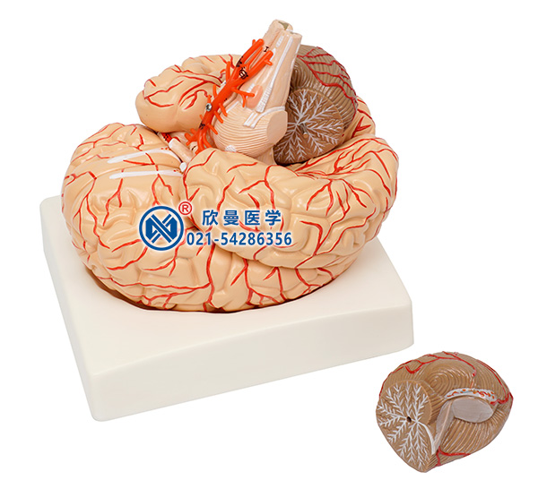 脑及脑动脉模型拆分为2部件