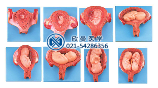 妊娠胚胎发育示教模型
