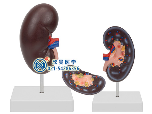 XM-705肾脏模型,肾脏解剖模型,肾脏解剖放大模型