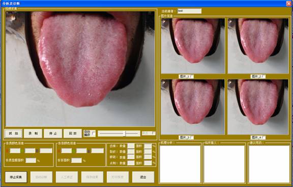 舌像仪视频采集