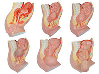 足月胎儿分娩过程模型（6部件）