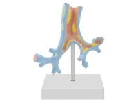 支气管病理模型
