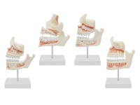 牙齿发育顺序过程模型（牙与颌骨的发育模型）