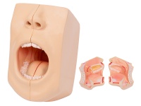 口腔模型